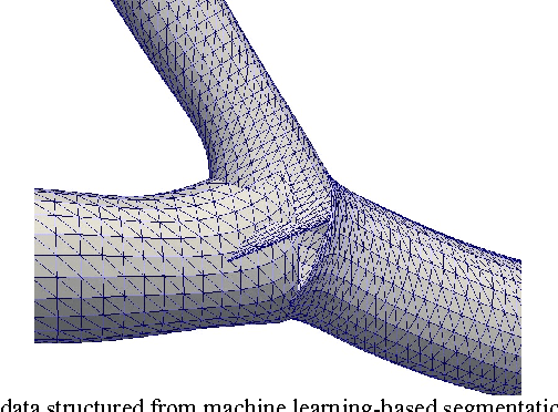Figure 3 for Implicit Tubular Surface Generation Guided by Centerline
