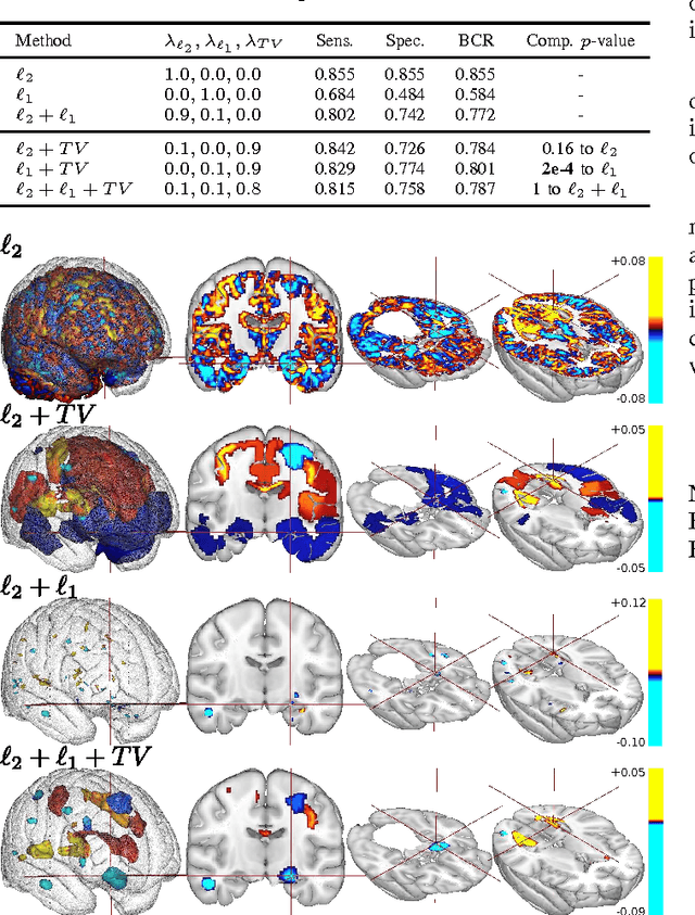 Figure 1 for Predictive support recovery with TV-Elastic Net penalty and logistic regression: an application to structural MRI
