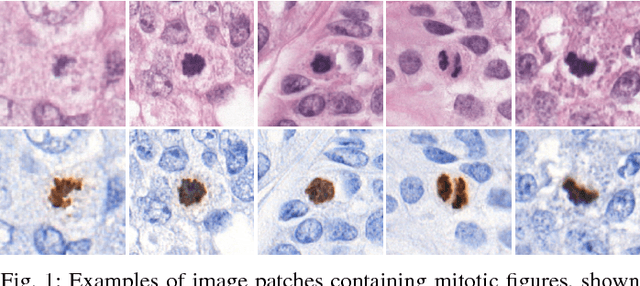 Figure 1 for Whole-Slide Mitosis Detection in H&E Breast Histology Using PHH3 as a Reference to Train Distilled Stain-Invariant Convolutional Networks