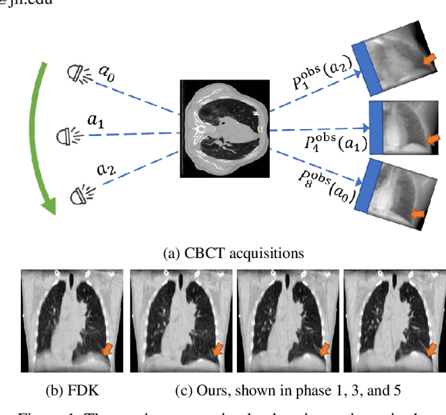 Figure 1 for REGAS: REspiratory-GAted Synthesis of Views for Multi-Phase CBCT Reconstruction from a single 3D CBCT Acquisition