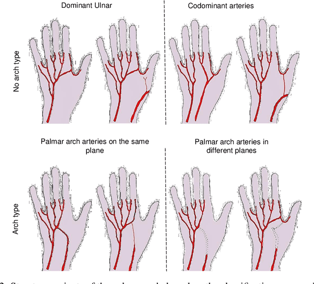 Figure 3 for Towards the Generation of Synthetic Images of Palm Vein Patterns: A Review