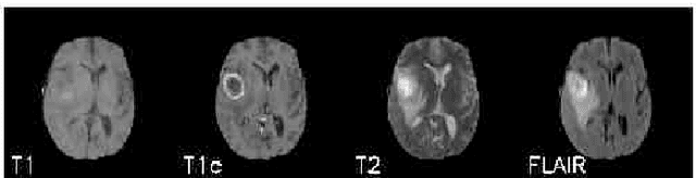 Figure 1 for Deep Learning-based Type Identification of Volumetric MRI Sequences