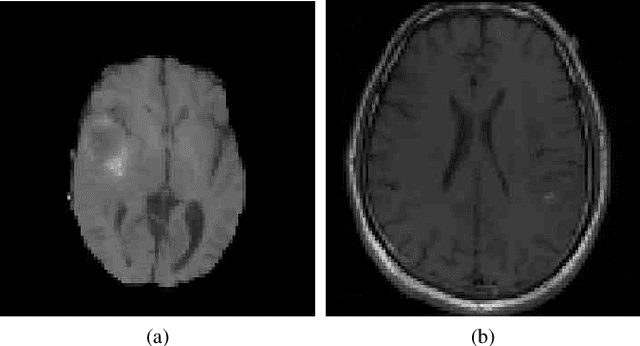 Figure 3 for Deep Learning-based Type Identification of Volumetric MRI Sequences