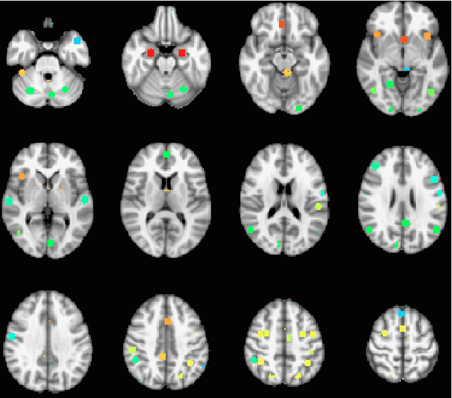 Figure 3 for Nonlinear functional mapping of the human brain