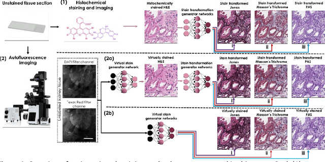 Figure 1 for Deep learning-based transformation of the H&E stain into special stains improves kidney disease diagnosis