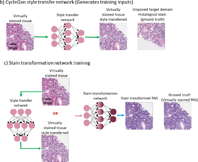 Figure 3 for Deep learning-based transformation of the H&E stain into special stains improves kidney disease diagnosis