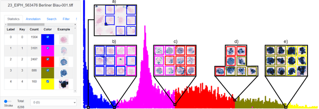 Figure 3 for Inter-Species Cell Detection: Datasets on pulmonary hemosiderophages in equine, human and feline specimens