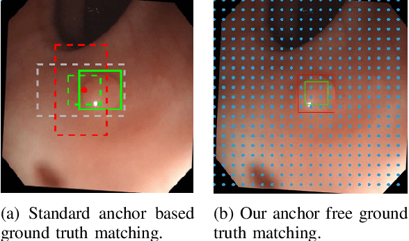 Figure 3 for AFP-Net: Realtime Anchor-Free Polyp Detection in Colonoscopy