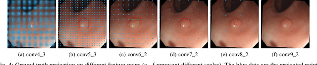 Figure 4 for AFP-Net: Realtime Anchor-Free Polyp Detection in Colonoscopy