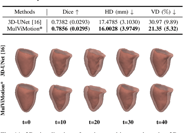 Figure 3 for MulViMotion: Shape-aware 3D Myocardial Motion Tracking from Multi-View Cardiac MRI
