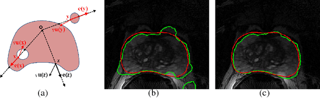 Figure 4 for Modern Convex Optimization to Medical Image Analysis