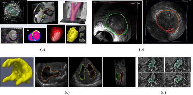 Figure 1 for Modern Convex Optimization to Medical Image Analysis