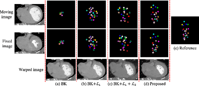 Figure 2 for Unsupervised Landmark Detection Based Spatiotemporal Motion Estimation for 4D Dynamic Medical Images