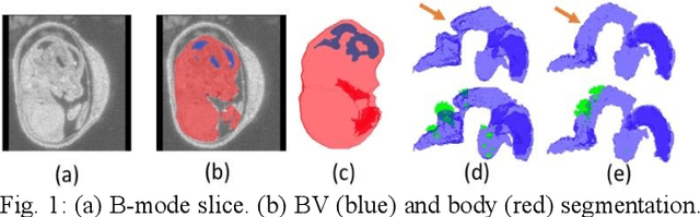 Figure 1 for Automatic Mouse Embryo Brain Ventricle & Body Segmentation and Mutant Classification From Ultrasound Data Using Deep Learning