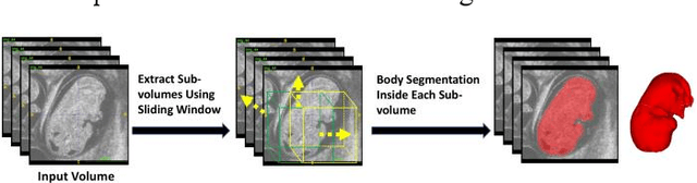 Figure 3 for Automatic Mouse Embryo Brain Ventricle & Body Segmentation and Mutant Classification From Ultrasound Data Using Deep Learning