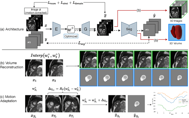 Figure 1 for DeepRecon: Joint 2D Cardiac Segmentation and 3D Volume Reconstruction via A Structure-Specific Generative Method