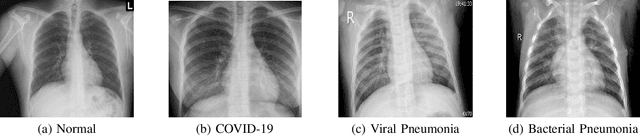 Figure 3 for Robust Screening of COVID-19 from Chest X-ray via Discriminative Cost-Sensitive Learning