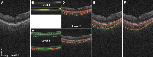 Figure 1 for Automated segmentation of choroidal layers from 3-dimensional macular optical coherence tomography scans
