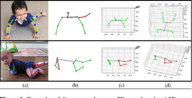Figure 1 for Computer Vision to the Rescue: Infant Postural Symmetry Estimation from Incongruent Annotations