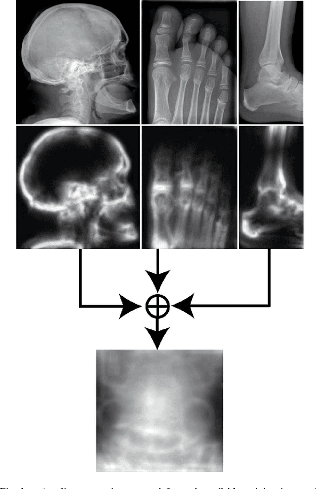 Figure 1 for Medical Image Classification via SVM using LBP Features from Saliency-Based Folded Data