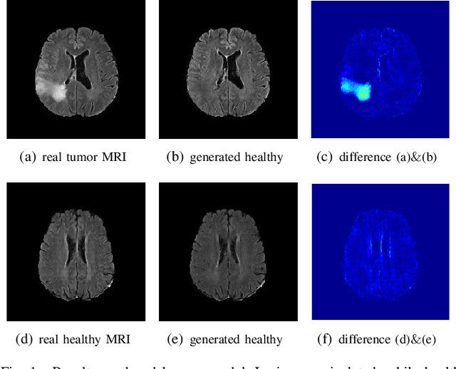 Figure 1 for An Adversarial Learning Approach to Medical Image Synthesis for Lesion Removal