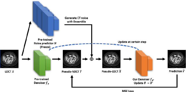 Figure 1 for Self-Supervised Learning based CT Denoising using Pseudo-CT Image Pairs
