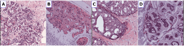 Figure 1 for Deep Convolutional Neural Networks for Breast Cancer Histology Image Analysis
