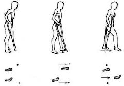 Figure 1 for Evaluating the Effect of Crutch-using on Trunk Muscle Loads