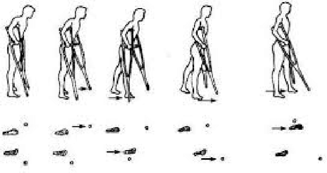 Figure 3 for Evaluating the Effect of Crutch-using on Trunk Muscle Loads
