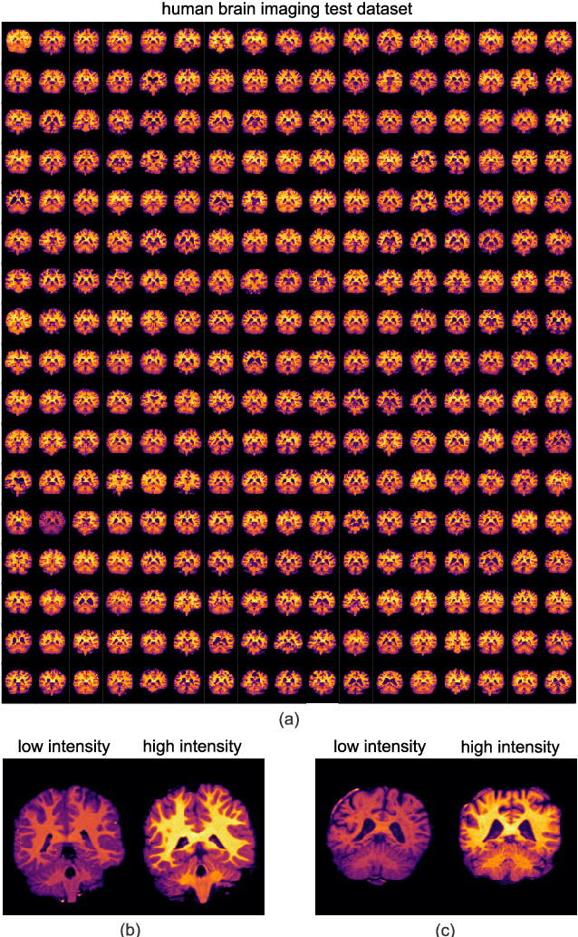 Figure 1 for Exploring Intensity Invariance in Deep Neural Networks for Brain Image Registration
