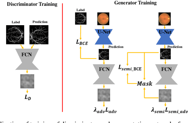 Figure 1 for Particle Swarm Optimization for Great Enhancement in Semi-Supervised Retinal Vessel Segmentation with Generative Adversarial Networks