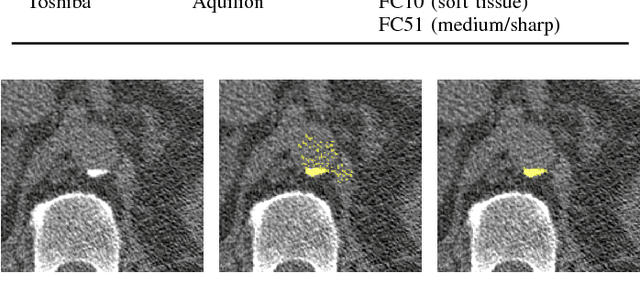 Figure 1 for Automatic calcium scoring in low-dose chest CT using deep neural networks with dilated convolutions