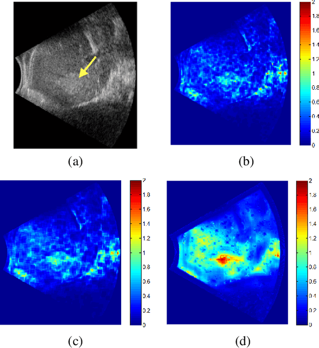 Figure 3 for Multiscale Nakagami parametric imaging for improved liver tumor localization