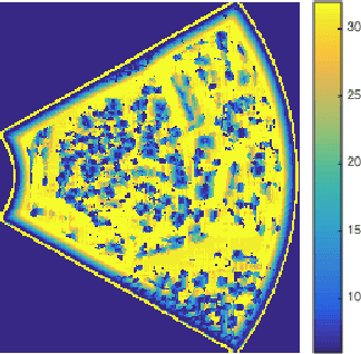Figure 4 for Multiscale Nakagami parametric imaging for improved liver tumor localization