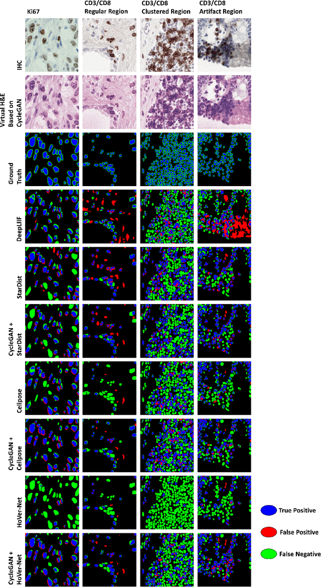 Figure 3 for Image Translation Based Nuclei Segmentation for Immunohistochemistry Images