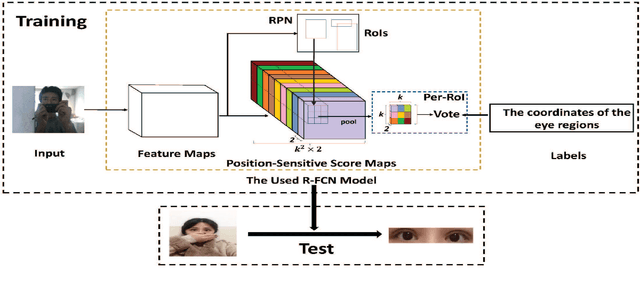 Figure 3 for Automated Strabismus Detection based on Deep neural networks for Telemedicine Applications