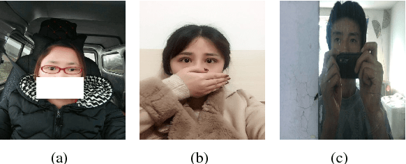 Figure 4 for Automated Strabismus Detection based on Deep neural networks for Telemedicine Applications
