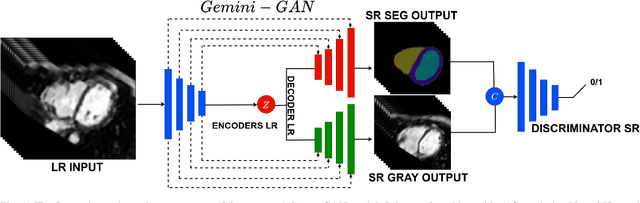 Figure 2 for Joint Semi-supervised 3D Super-Resolution and Segmentation with Mixed Adversarial Gaussian Domain Adaptation