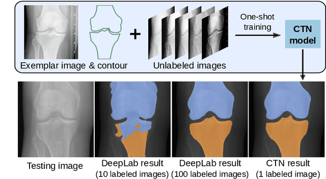 Figure 1 for Contour Transformer Network for One-shot Segmentation of Anatomical Structures