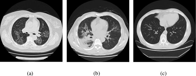 Figure 1 for Deep Learning System to Screen Coronavirus Disease 2019 Pneumonia