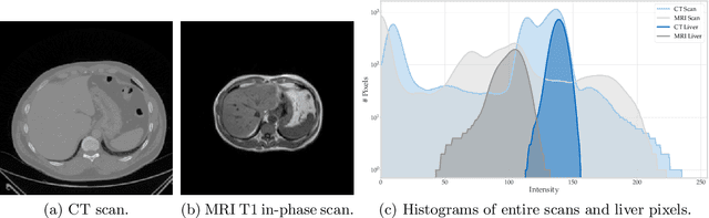 Figure 1 for FedNorm: Modality-Based Normalization in Federated Learning for Multi-Modal Liver Segmentation