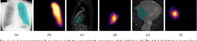 Figure 1 for Towards Robust Medical Image Segmentation on Small-Scale Data with Incomplete Labels