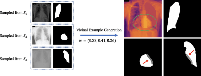Figure 2 for Towards Robust Medical Image Segmentation on Small-Scale Data with Incomplete Labels