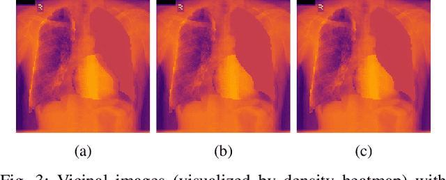 Figure 3 for Towards Robust Medical Image Segmentation on Small-Scale Data with Incomplete Labels