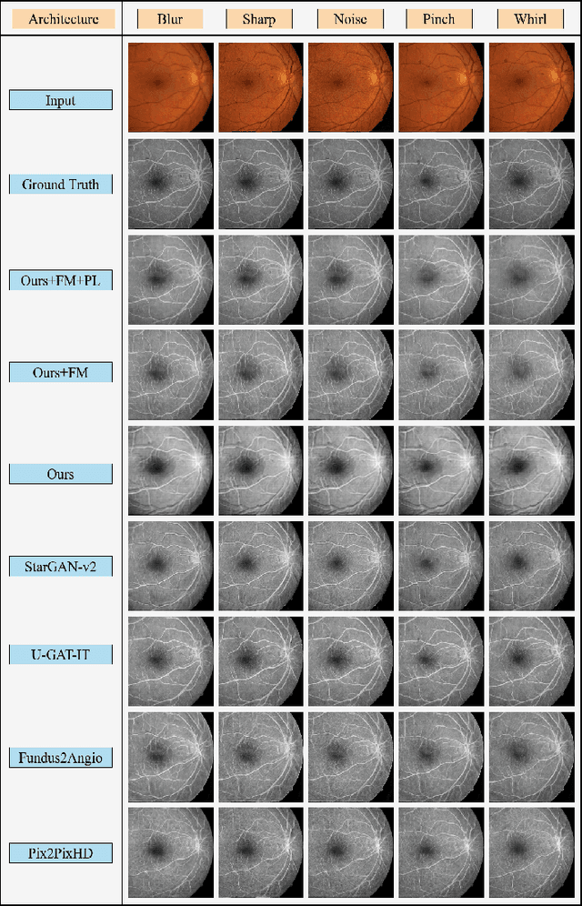 Figure 4 for Attention2AngioGAN: Synthesizing Fluorescein Angiography from Retinal Fundus Images using Generative Adversarial Networks