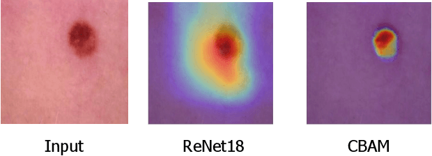 Figure 1 for Studying the Effects of Self-Attention for Medical Image Analysis