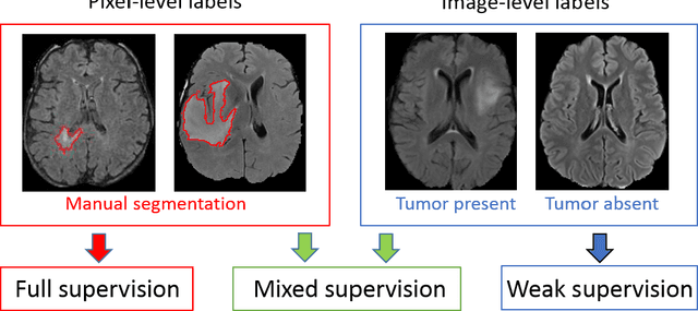Figure 1 for Deep Learning with Mixed Supervision for Brain Tumor Segmentation