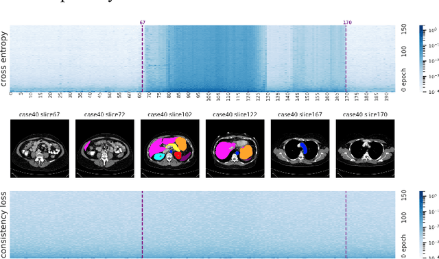 Figure 1 for AdaWAC: Adaptively Weighted Augmentation Consistency Regularization for Volumetric Medical Image Segmentation