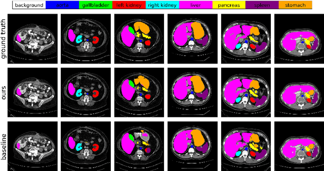 Figure 3 for AdaWAC: Adaptively Weighted Augmentation Consistency Regularization for Volumetric Medical Image Segmentation