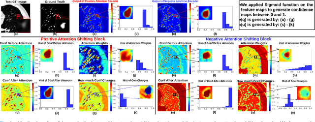 Figure 2 for MisMatch: Learning to Change Predictive Confidences with Attention for Consistency-Based, Semi-Supervised Medical Image Segmentation